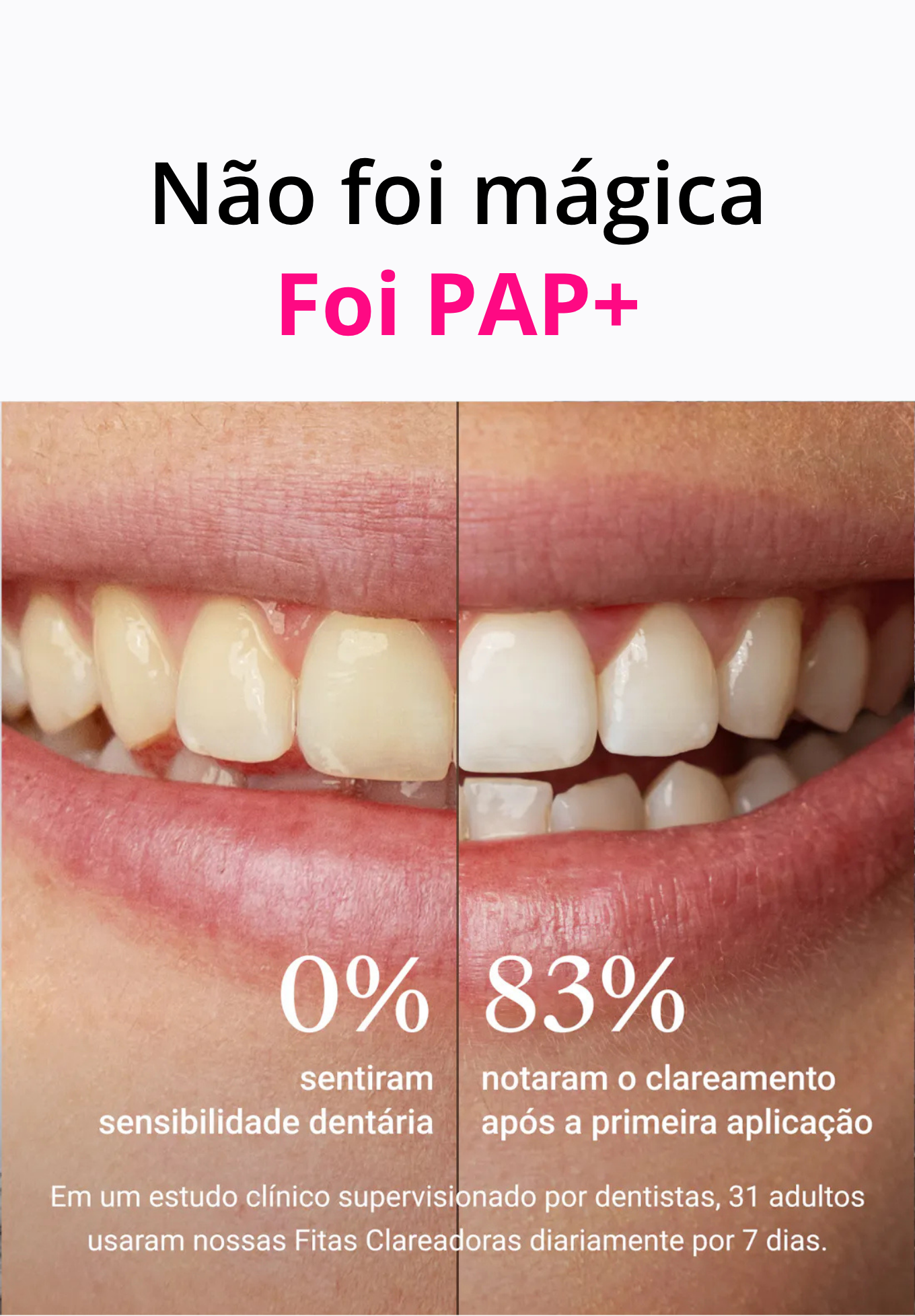 Tiras de Clareamento Dental PAP+